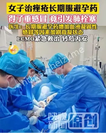 口服避孕药与血栓风险